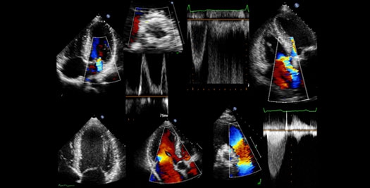 Structural Heart Core Lab_aangepast.png-1