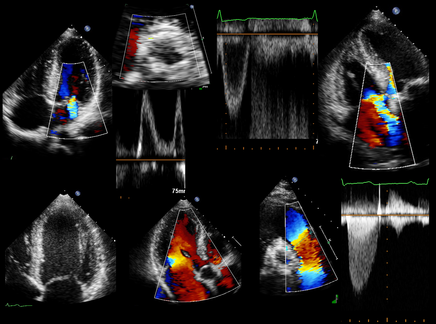 Structural Heart Core Lab